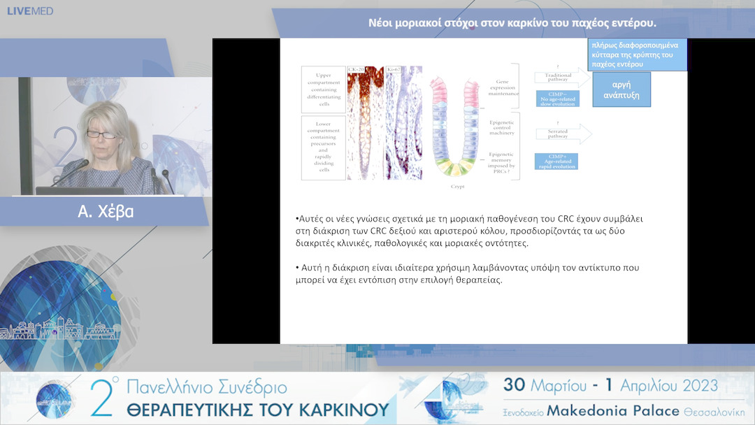 30 Α.Χέβα - Νέοι μοριακοί στόχοι στον καρκίνο του παχέος εντέρου. 