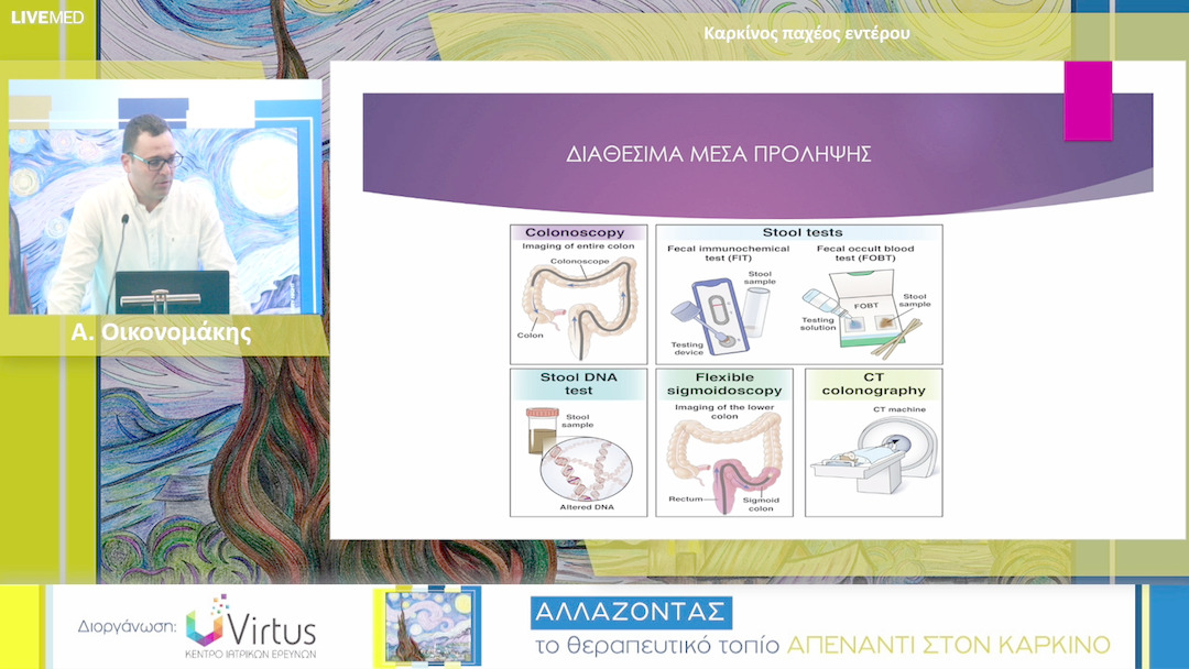 30 Α. Οικονομάκης - Καρκίνος παχέος εντέρου 