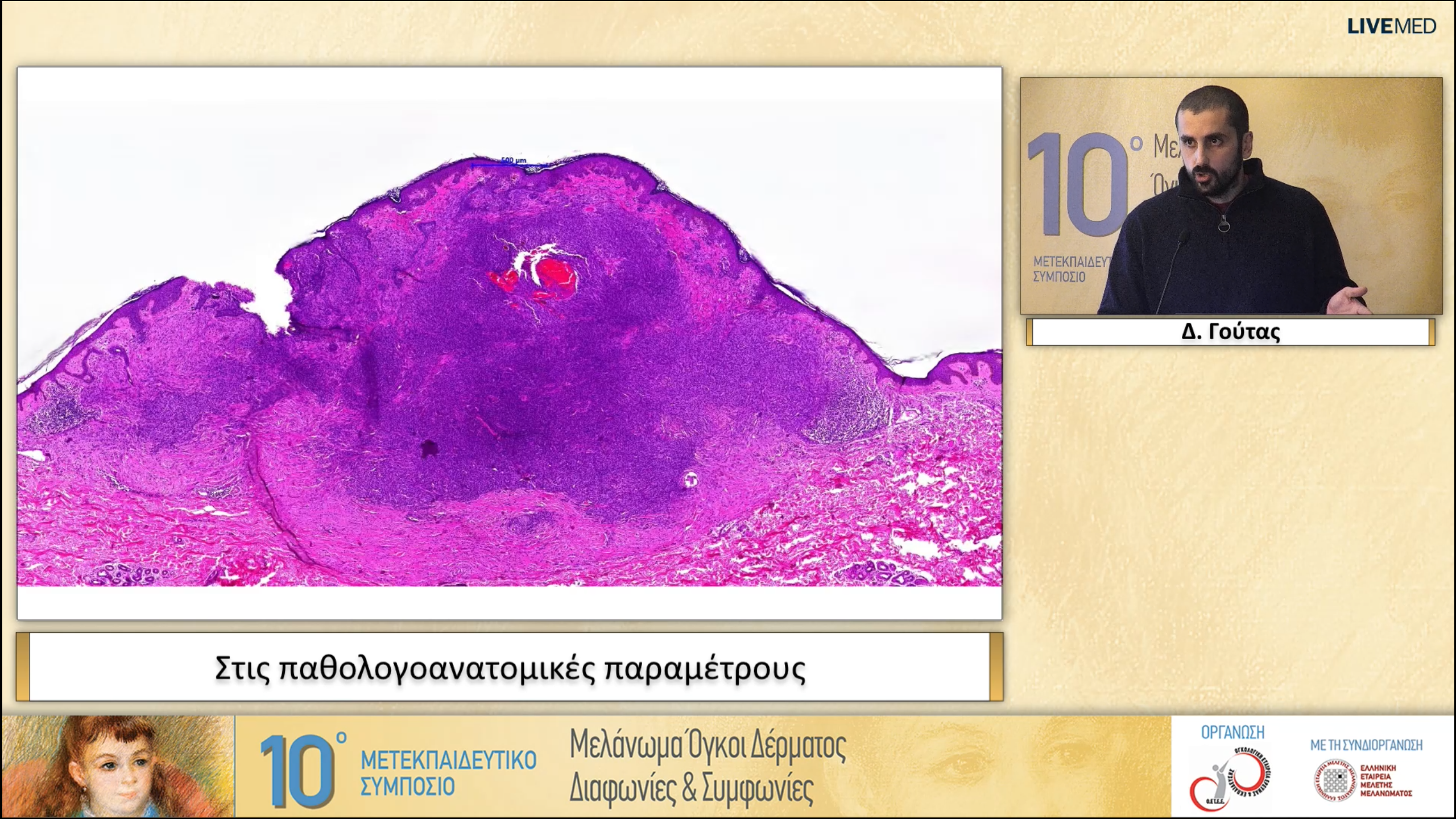 23 Δ. Γούτας - Στις παθολογοανατομικές παραμέτρους