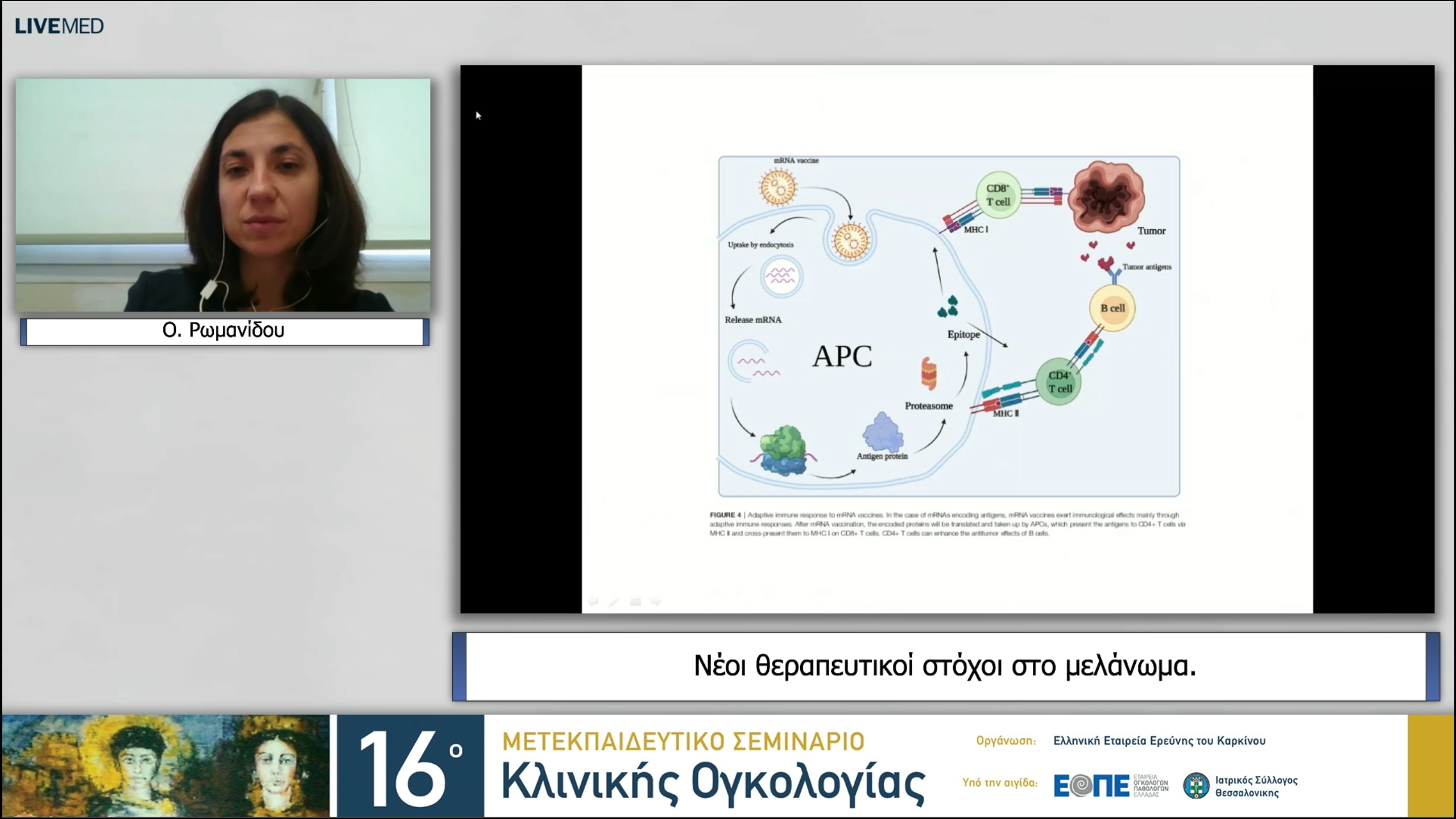 25 Ο. Ρωμανίδου - Νέοι θεραπευτικοί στόχοι στο μελάνωμα. 