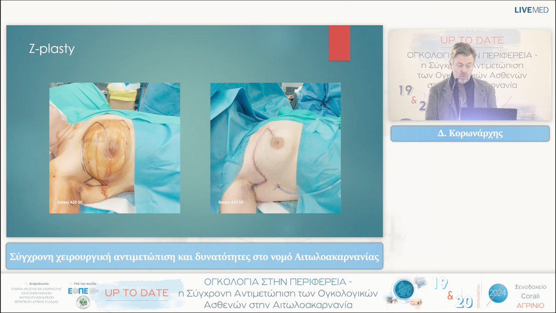 40 Δ. Κορωνάρχης - Σύγχρονη χειρουργική αντιμετώπιση και δυνατότητες στο νομό Αιτωλοακαρνανίας 
