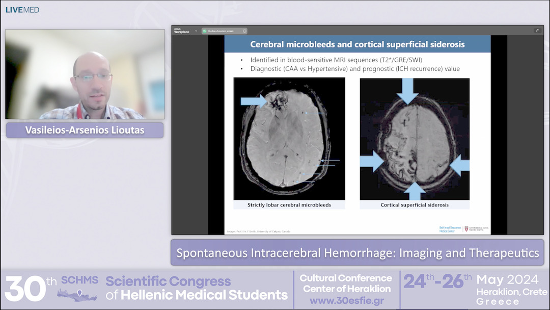 40 Vasileios-Arsenios Lioutas - Spontaneous Intracerebral Hemorrhage: Imaging and Therapeutics