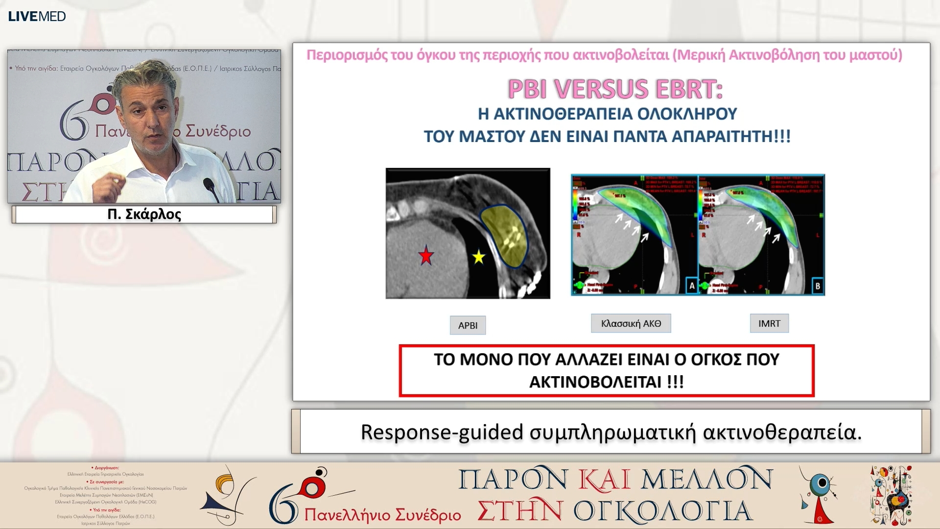 47 Π. Σκάρλος - Response-guided συμπληρωματική ακτινοθεραπεία. 