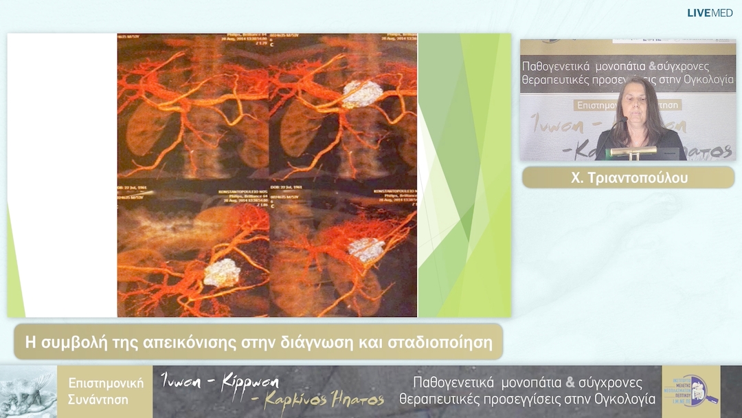 27 Χ. Τριαντοπούλου - Η συμβολή της απεικόνισης στην διάγνωση και σταδιοποίηση 