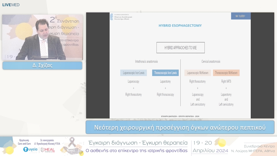 32 Δ. Σχίζας - Νεότερη χειρουργική προσέγγιση όγκων ανώτερου πεπτικού 