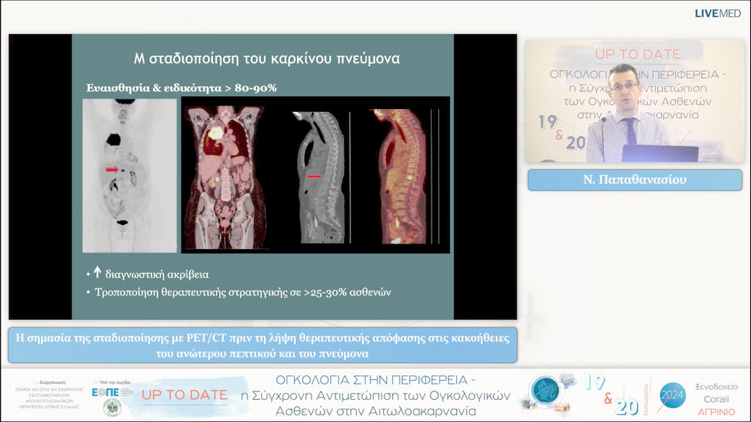 38 Ν. Παπαθανασίου - Η σημασία της σταδιοποίησης με PET/CT πριν τη λήψη θεραπευτικής απόφασης στις κακοήθειες του ανώτερου πεπτικού και του πνεύμονα 