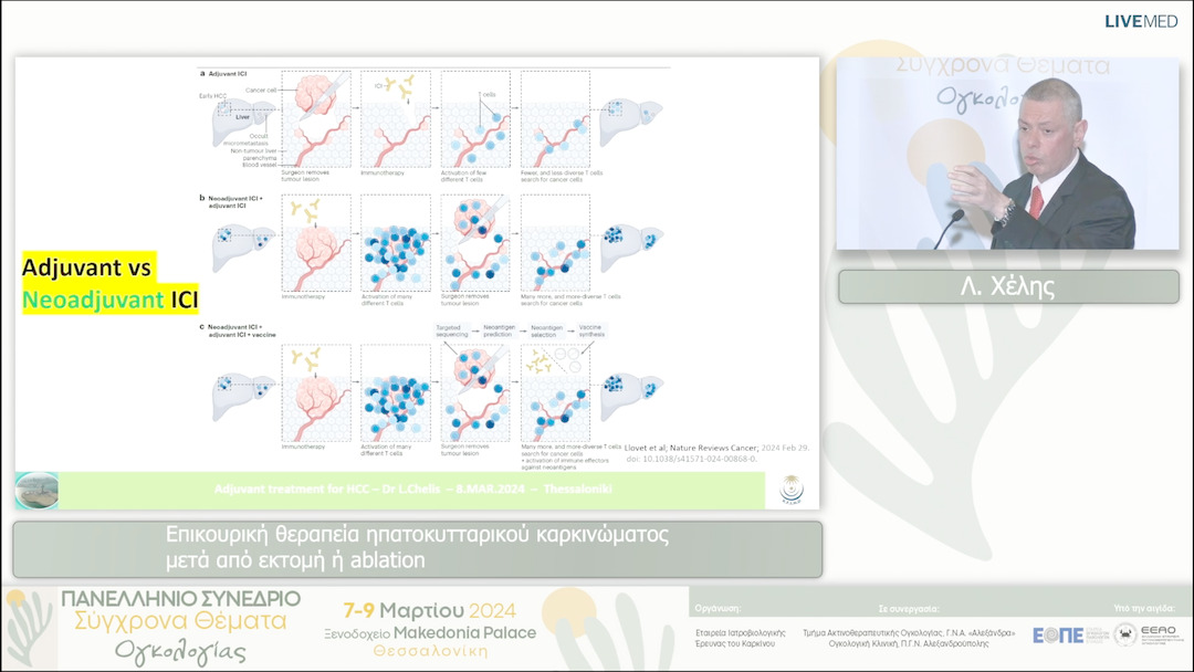 18 Λ. Χέλης - Επικουρική θεραπεία ηπατοκυτταρικού καρκινώματος μετά από εκτομή ή ablation 