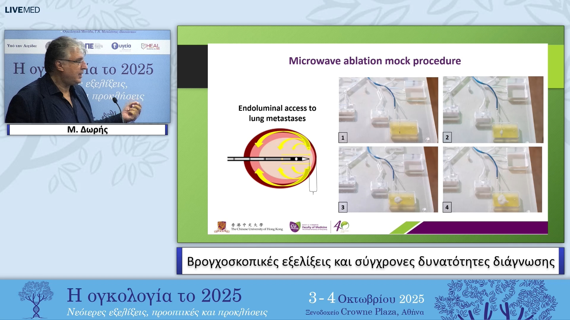 33 Μ. Δωρής - Βρογχοσκοπικές εξελίξεις και σύγχρονες δυνατότητες διάγνωσης