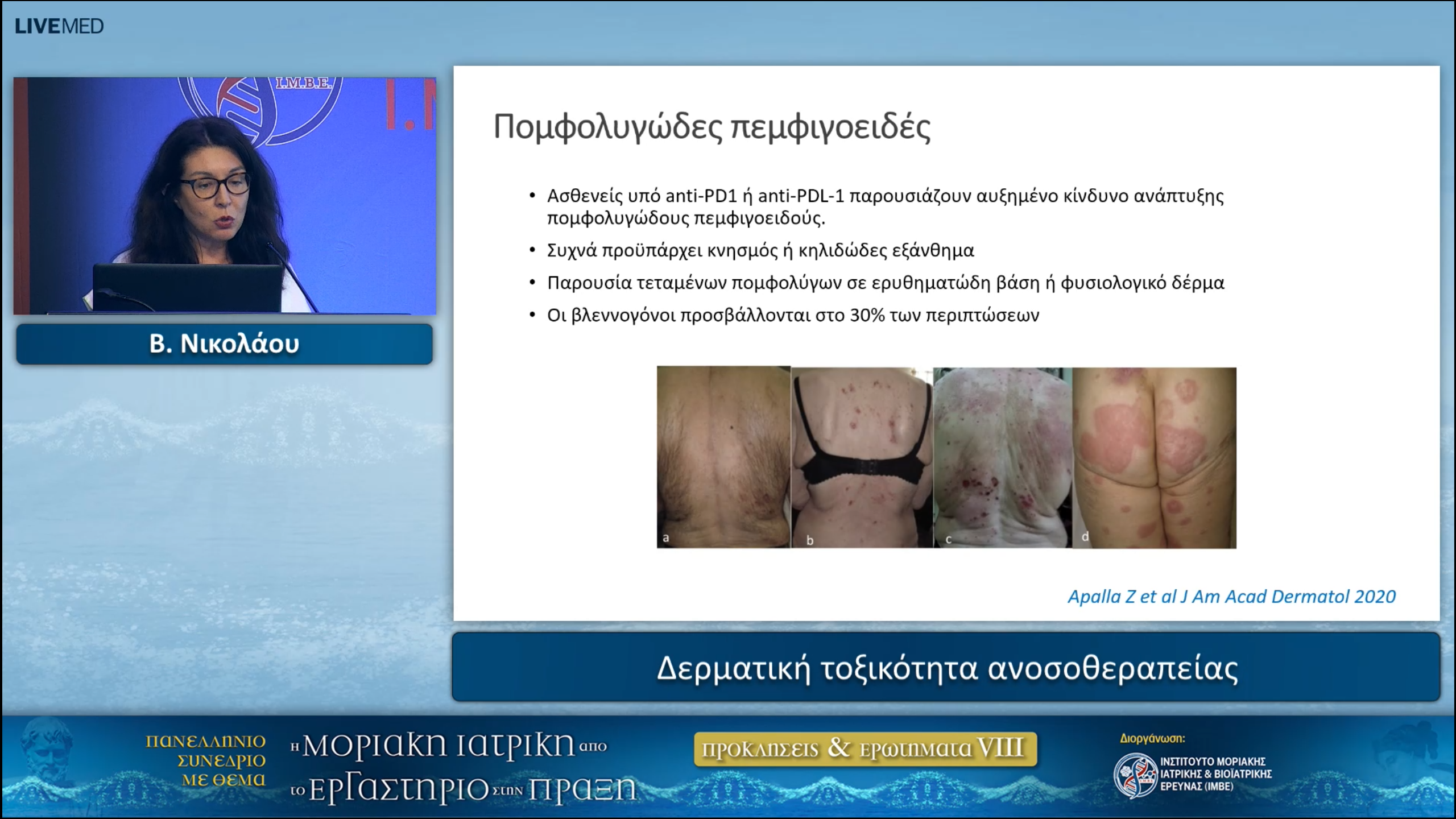 35 V. Nikolaou - Cutaneous toxicity in immunotherapy 