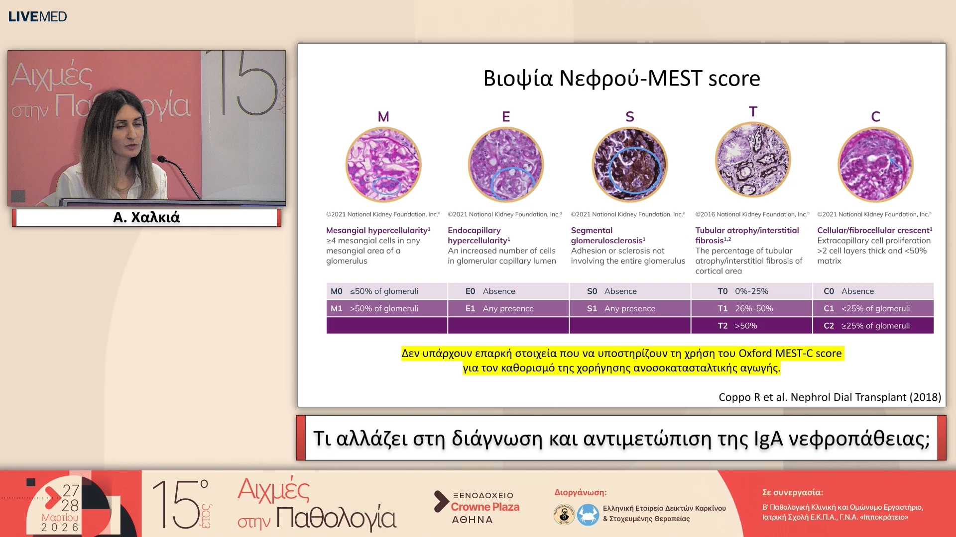 30 Α. Χαλκιά - Τι αλλάζει στη διάγνωση και αντιμετώπιση της IgA νεφροπάθειας;