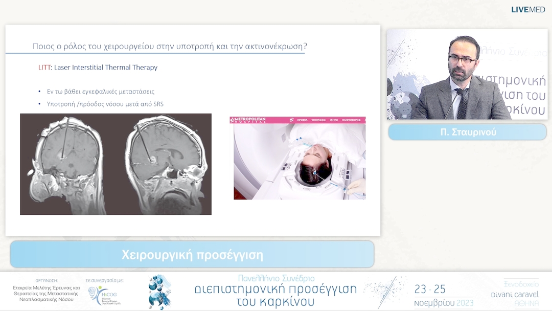 54 Π. Σταυρινού - Χειρουργική προσέγγιση 
