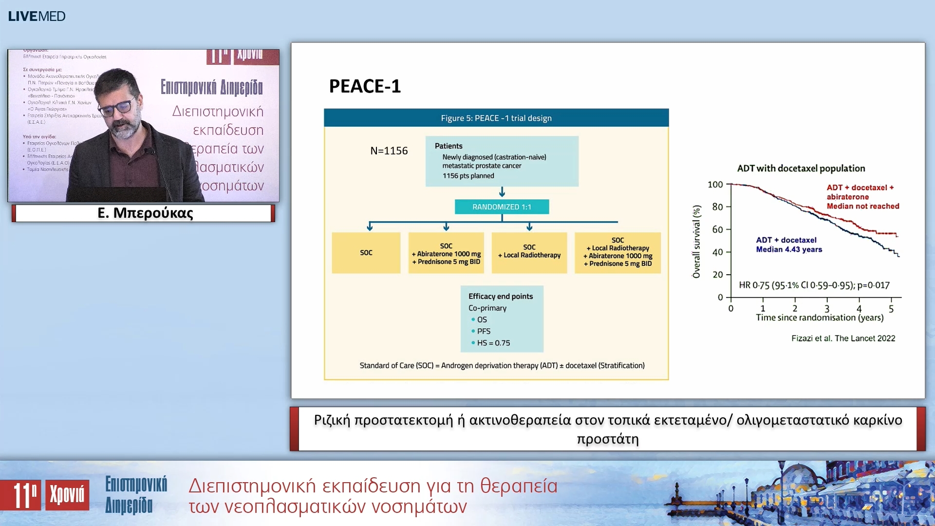 27 Ε. Μπερούκας - Ριζική προστατεκτομή ή ακτινοθεραπεία στον τοπικά εκτεταμένο/ ολιγομεταστατικό καρκίνο προστάτη