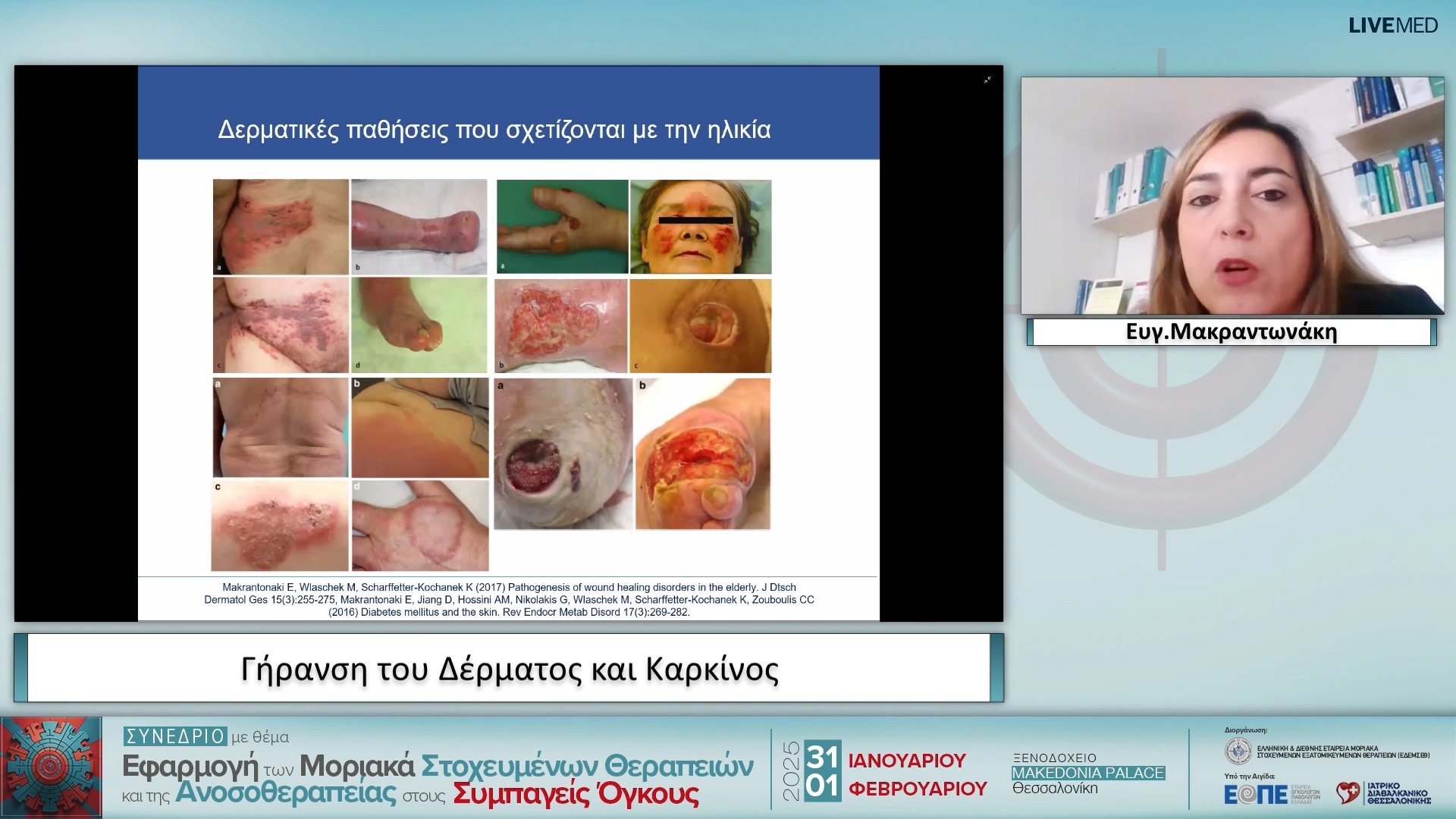 26 Ευγ. Μακραντωνάκη - Γήρανση του Δέρματος και Καρκίνος