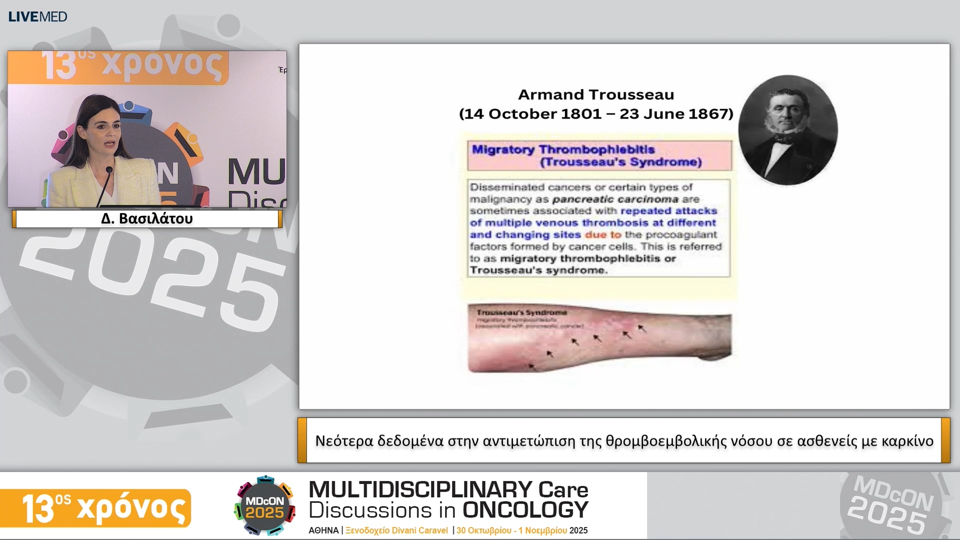 22 Δ. Βασιλάτου - Νεότερα δεδομένα στην αντιμετώπιση της θρομβοεμβολικής νόσου σε ασθενείς με καρκίνο