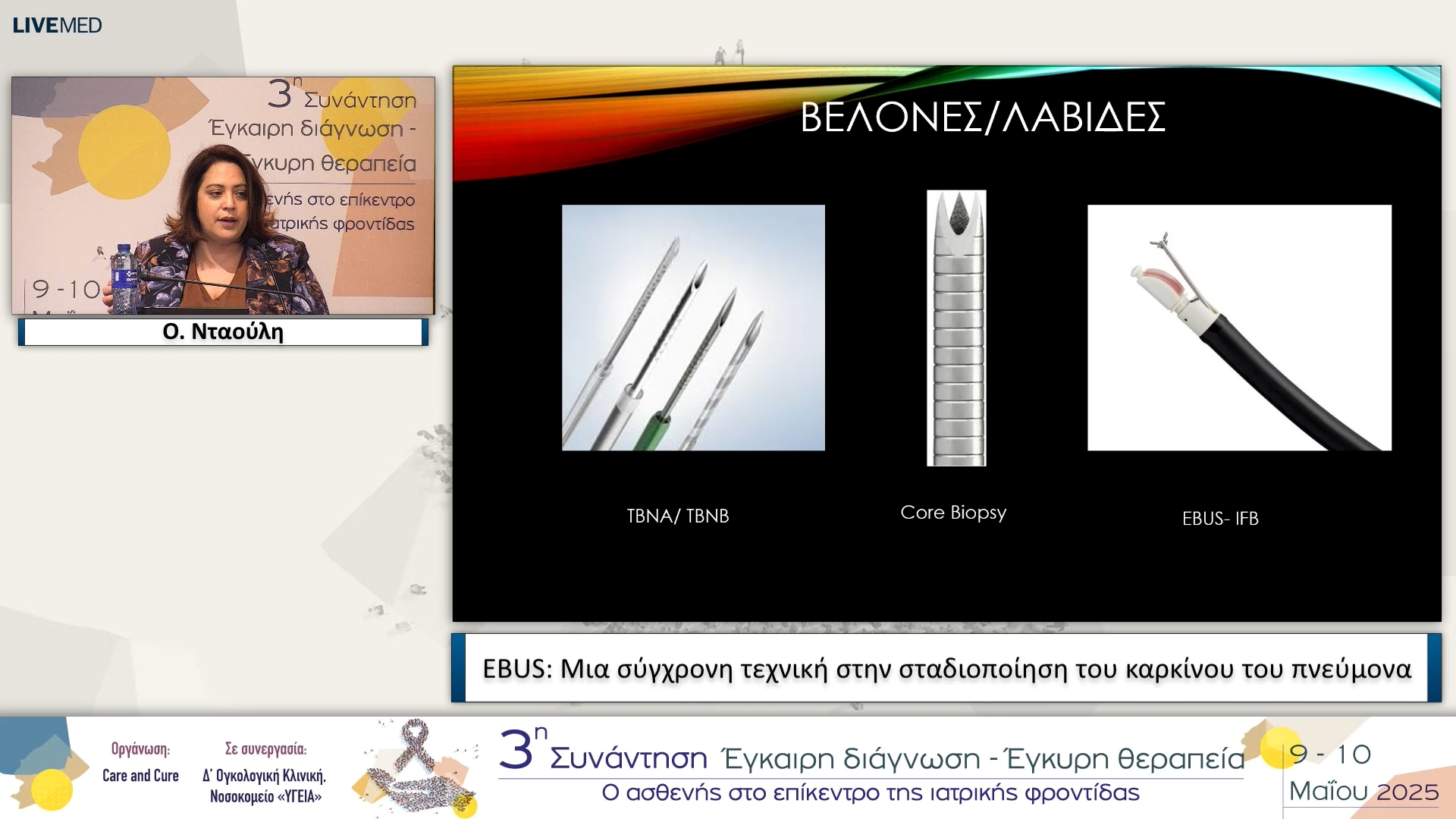 36 Ο. Νταούλη - EBUS: Μια σύγχρονη τεχνική στην σταδιοποίηση του καρκίνου του πνεύμονα