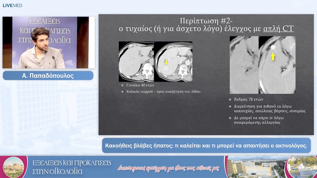 38 Α. Παπαδόπουλος - Κακοήθεις βλάβες ήπατος: τι καλείται και τι μπορεί να απαντήσει ο ακτινολόγος. 