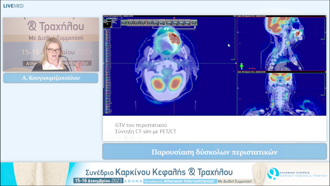 39 Α. Κουγιουμτζοπούλου - Παρουσίαση δύσκολων περιστατικών