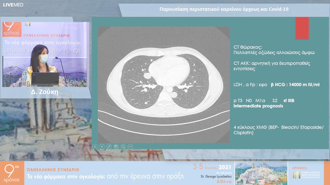 15 Δ. Ζούκη - Παρουσίαση περιστατικού καρκίνου όρχεως και Covid-19 