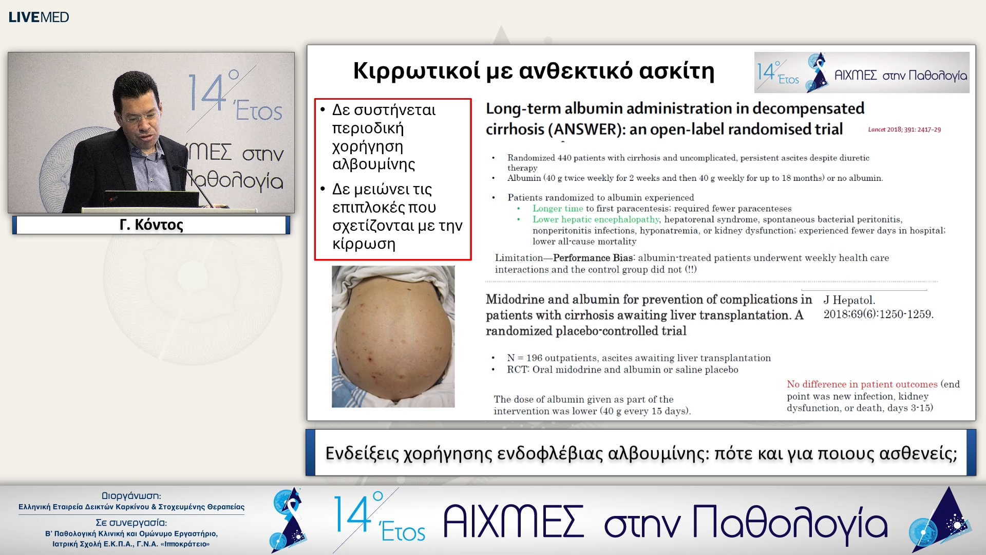48 Γ. Κόντος - Ενδείξεις χορήγησης ενδοφλέβιας αλβουμίνης: πότε και για ποιους ασθενείς;