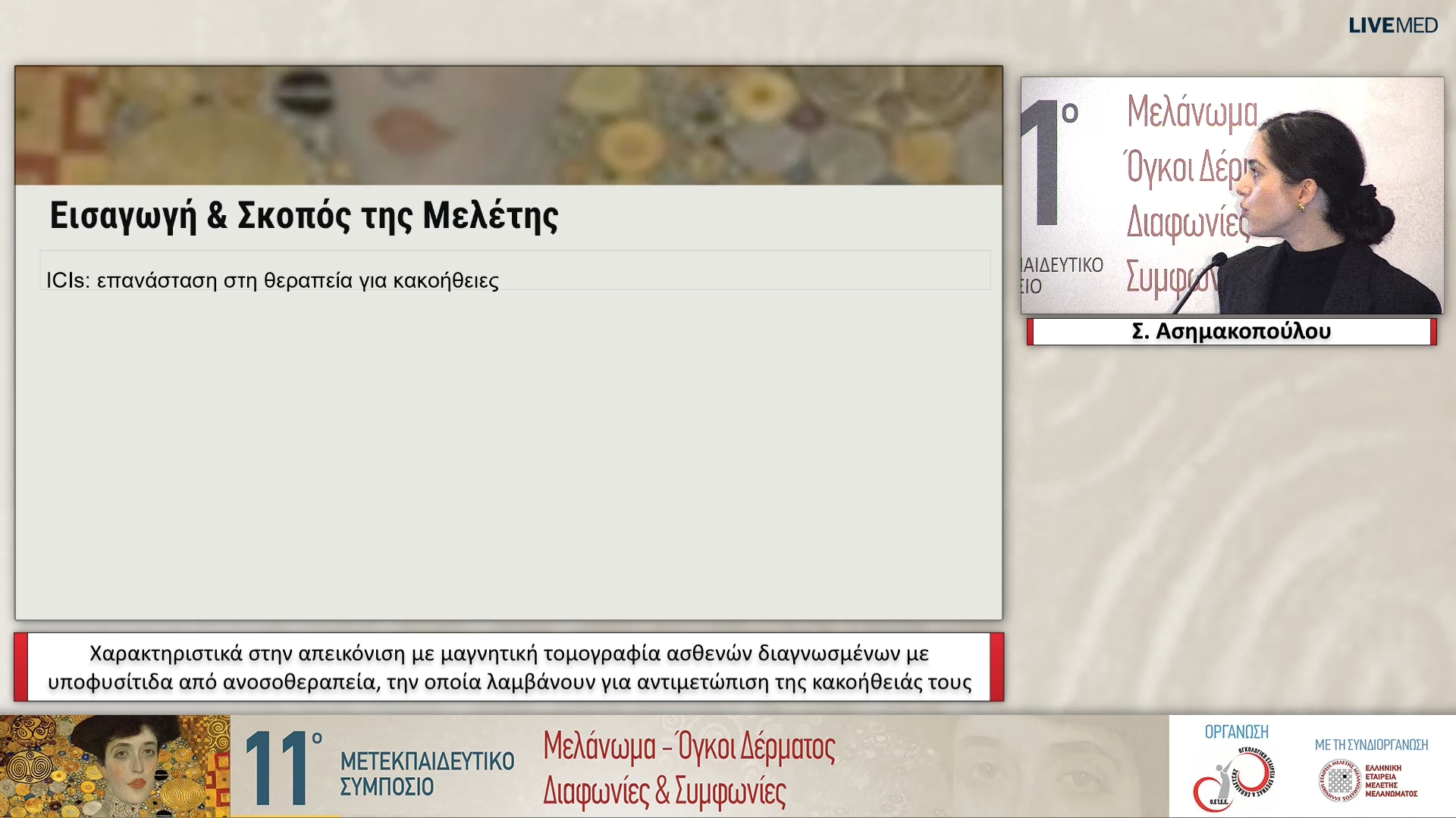 28 Σ. Ασημακοπούλου - Χαρακτηριστικά στην απεικόνιση με μαγνητική τομογραφία ασθενών διαγνωσμένων με υποφυσίτιδα από ανοσοθεραπεία, την οποία λαμβάνουν για αντιμετώπιση της κακοήθειάς τους 