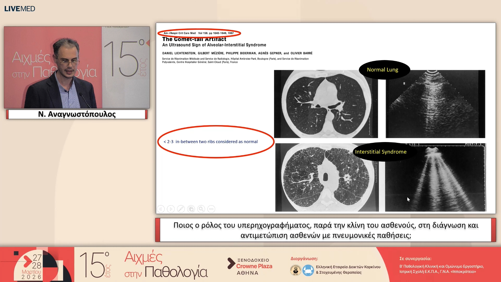 34 Ν. Αναγνωστόπουλος - Ποιος ο ρόλος του υπερηχογραφήματος, παρά την κλίνη του ασθενούς, στη διάγνωση και αντιμετώπιση ασθενών με πνευμονικές παθήσεις;