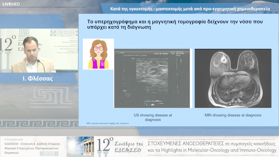 29  Ι. Φλέσσας - Κατά της ογκεκτομής - μαστεκτομής μετά από προ-εγχειρητική χημειοθεραπεία