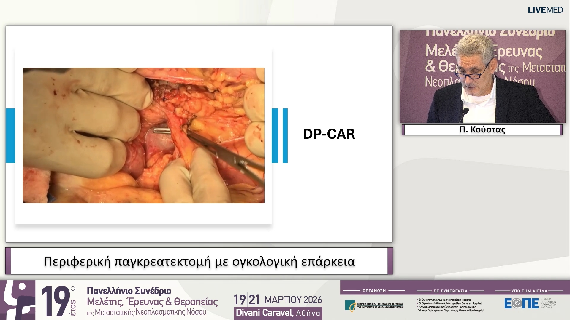 23 Π. Κούστας - Περιφερική παγκρεατεκτομή με ογκολογική επάρκεια
