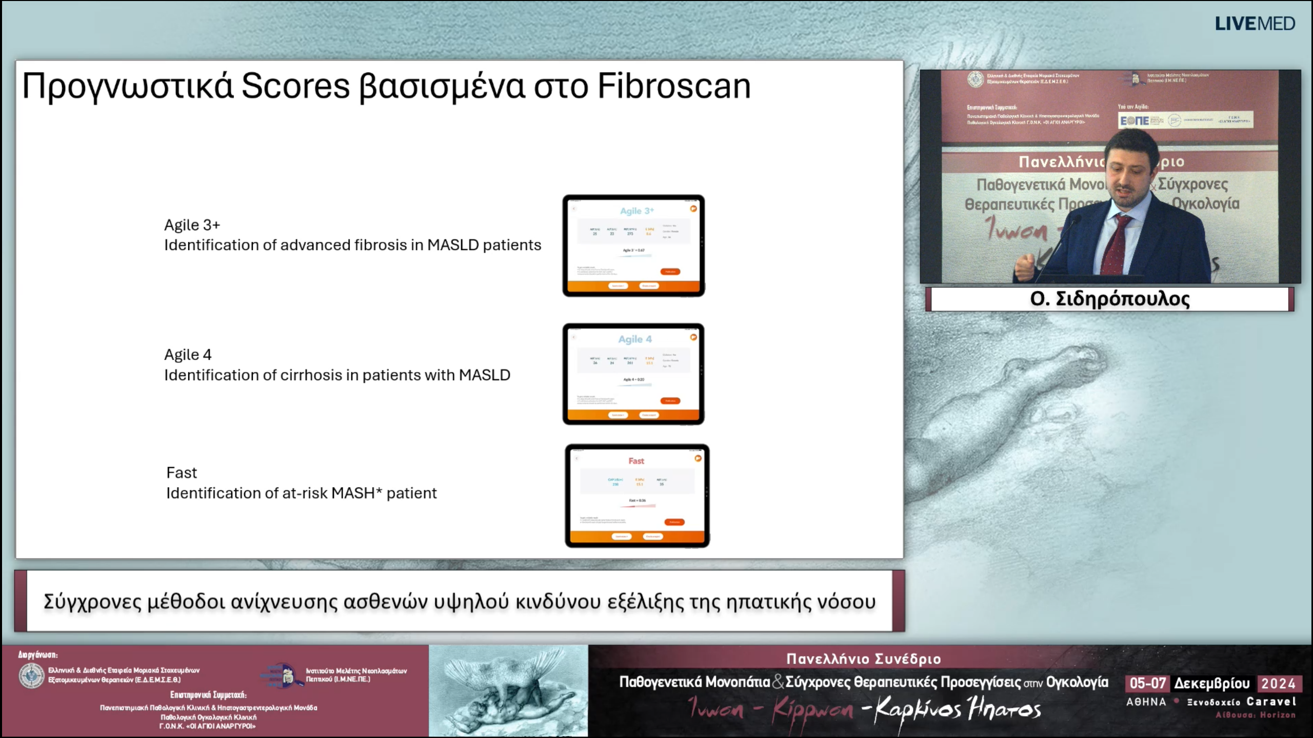 34 Ο. Σιδηρόπουλος - Σύγχρονες μέθοδοι ανίχνευσης ασθενών υψηλού κινδύνου εξέλιξης της ηπατικής νόσου