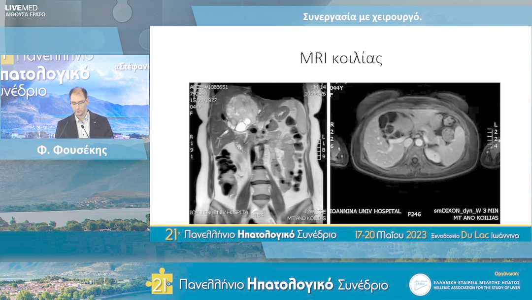 41 Φ. Φουσέκης, Γ. Γκλαντζούνης - Συνεργασία με χειρουργό.
