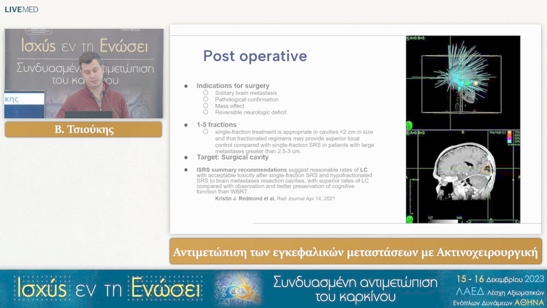 41 Β. Τσιούκης - Αντιμετώπιση των εγκεφαλικών μεταστάσεων με Ακτινοχειρουργική 