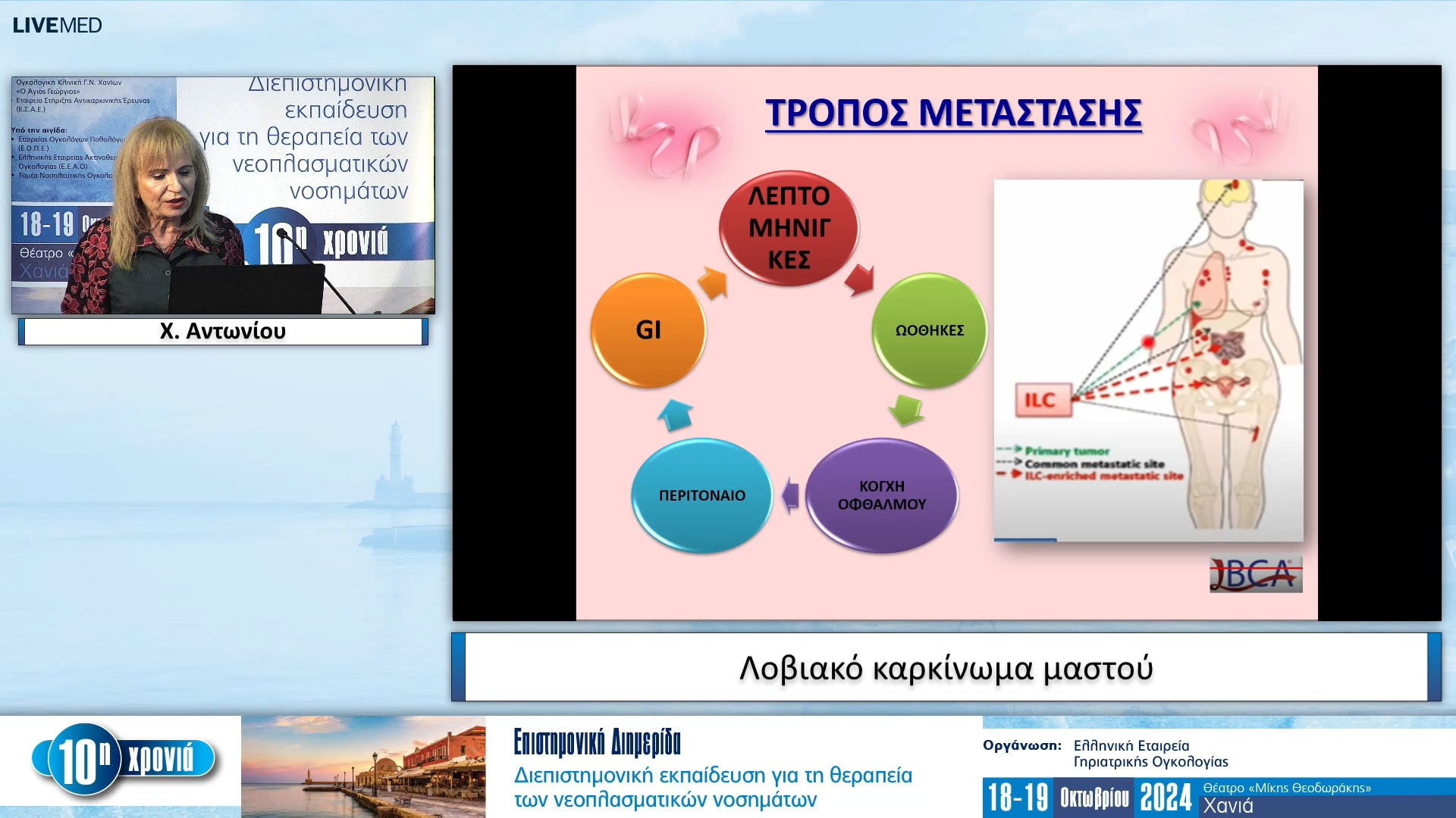 12  Χ. Αντωνίου - Λοβιακό καρκίνωμα μαστού