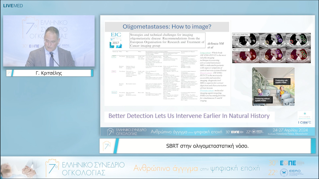 15 Γ. Κριτσέλης - SBRT στην ολιγομεταστατική νόσο. 