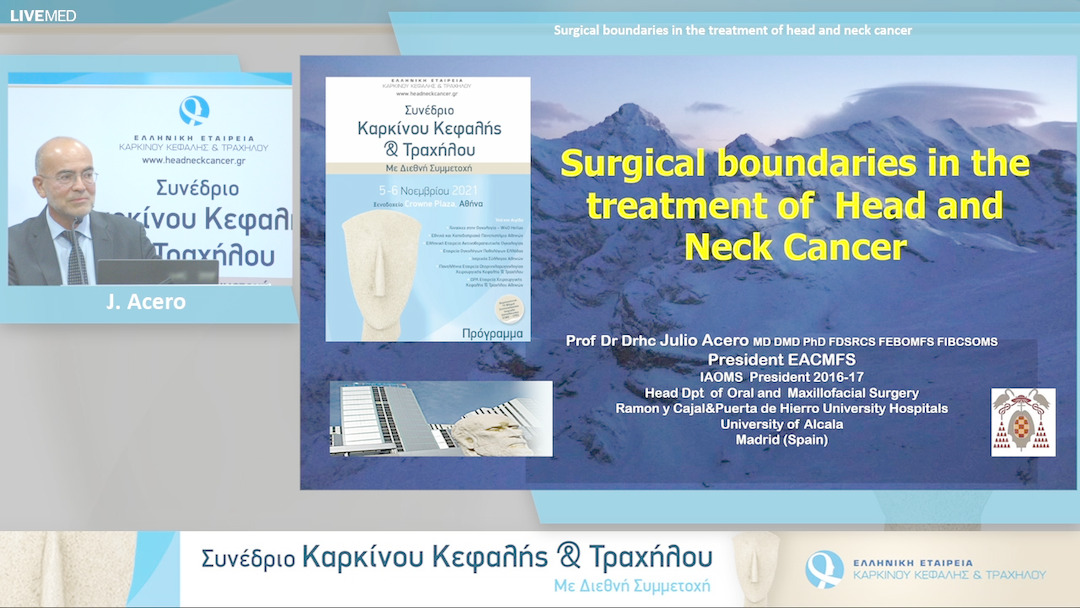 53 J. Acero - Surgical boundaries in the treatment of head and neck cancer 