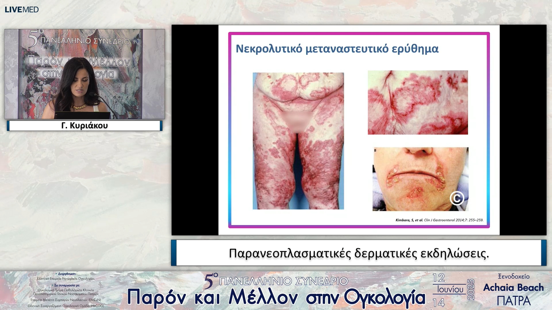 14 Γ. Κυριάκου - Παρανεοπλασματικές δερματικές εκδηλώσεις.