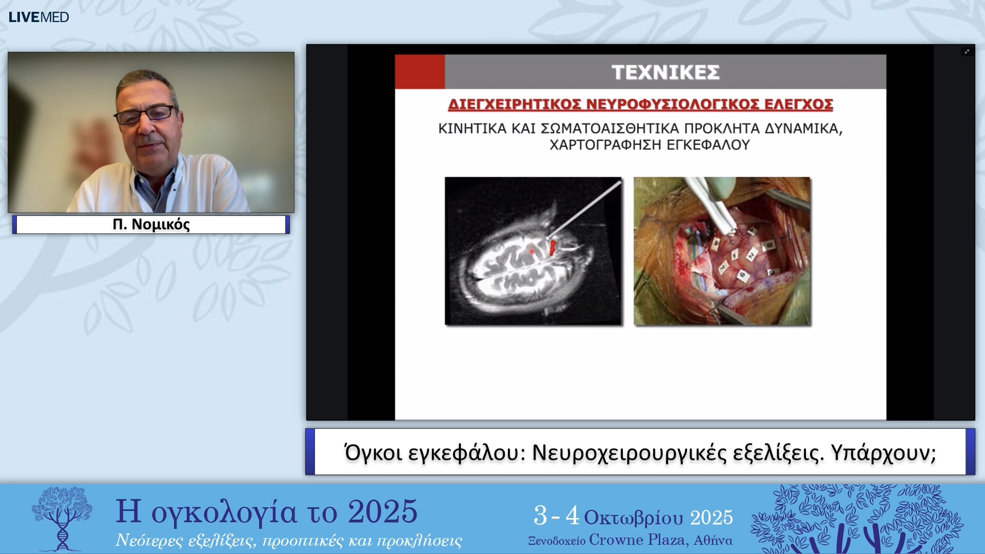 07 Π. Νομικός - Όγκοι εγκεφάλου: Νευροχειρουργικές εξελίξεις. Υπάρχουν;