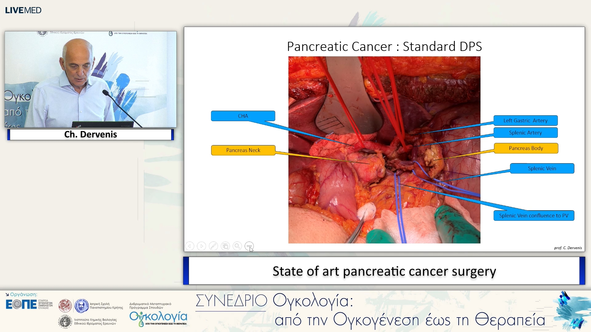 41 Ch. Dervenis - State of art pancreatic cancer surgery. 