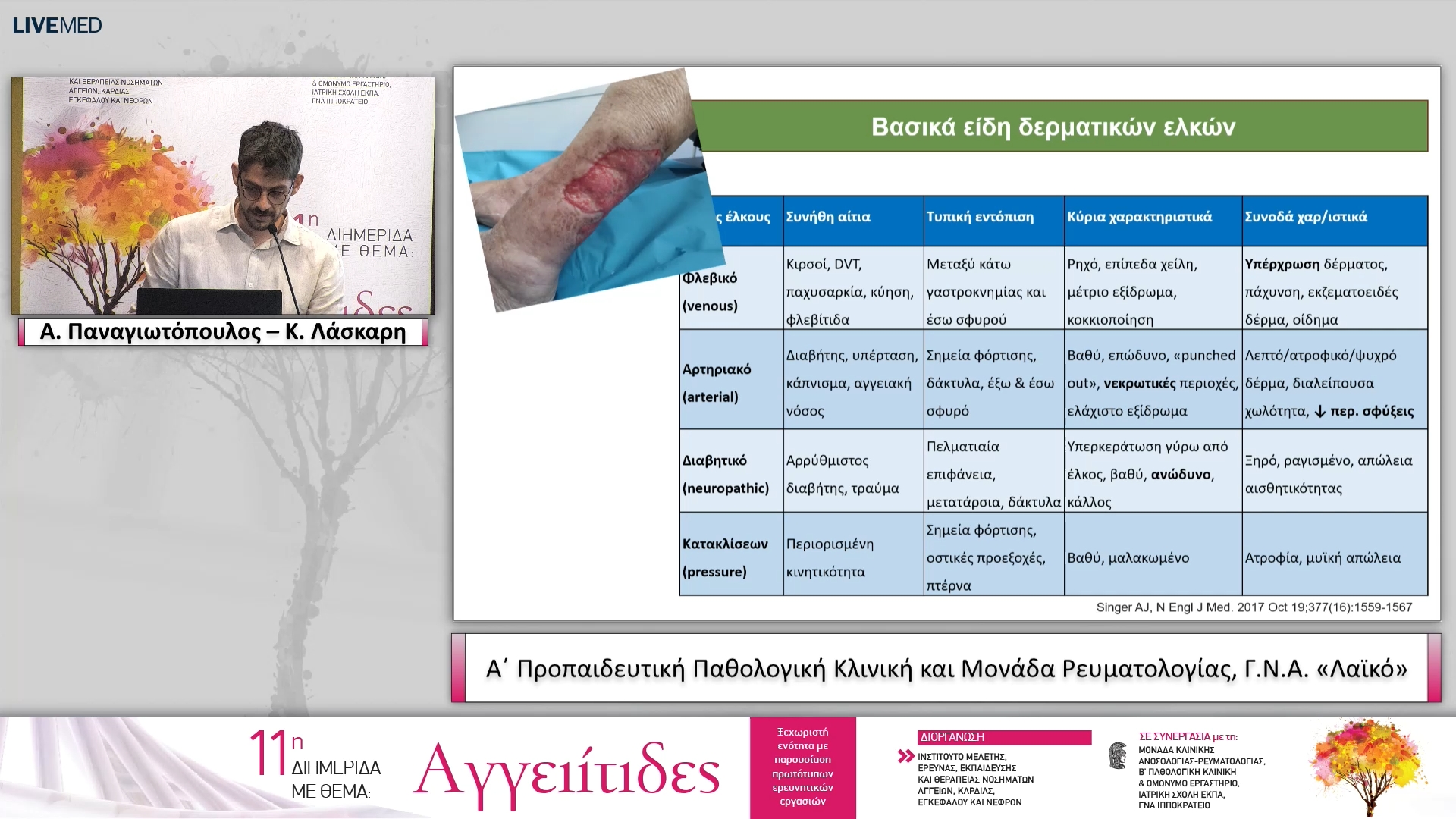 38 Α. Παναγιωτόπουλος – Κ. Λάσκαρη Α΄ Προπαιδευτική Παθολογική Κλινική και Μονάδα Ρευματολογίας, Γ.Ν.Α. «Λαϊκό»