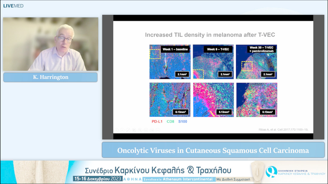 42 K. Harrington - Oncolytic Viruses in Cutaneous Squamous Cell Carcinoma 