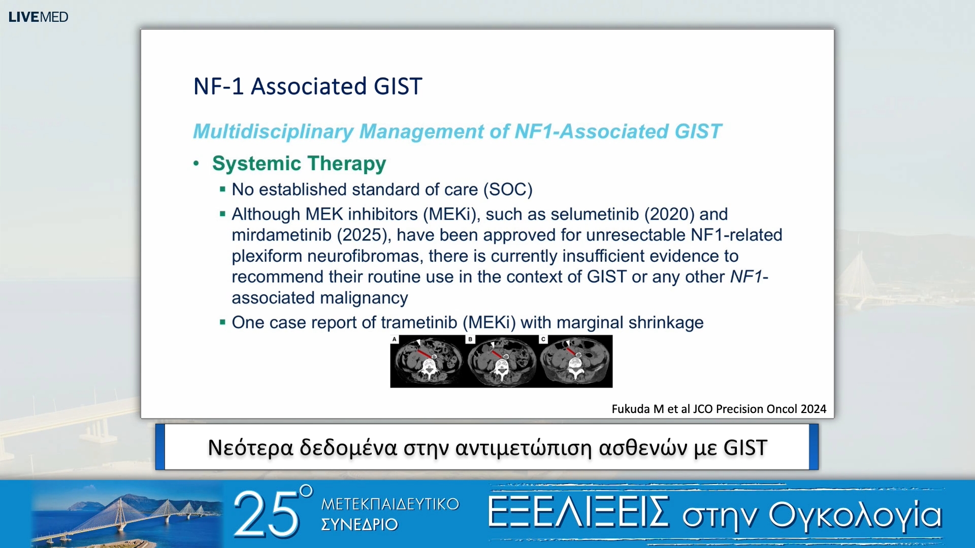 37 Ι. Μπουκοβίνας - Νεότερα δεδομένα στην αντιμετώπιση ασθενών με GIST
