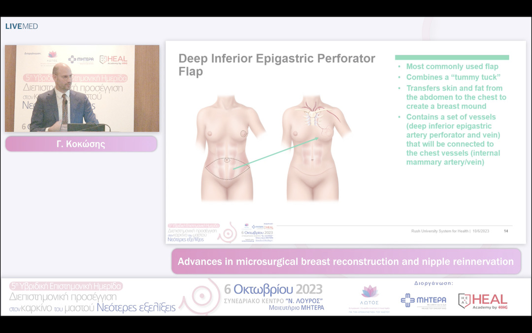 30 Γ. Κοκώσης - Advances in microsurgical breast reconstruction and nipple reinnervation