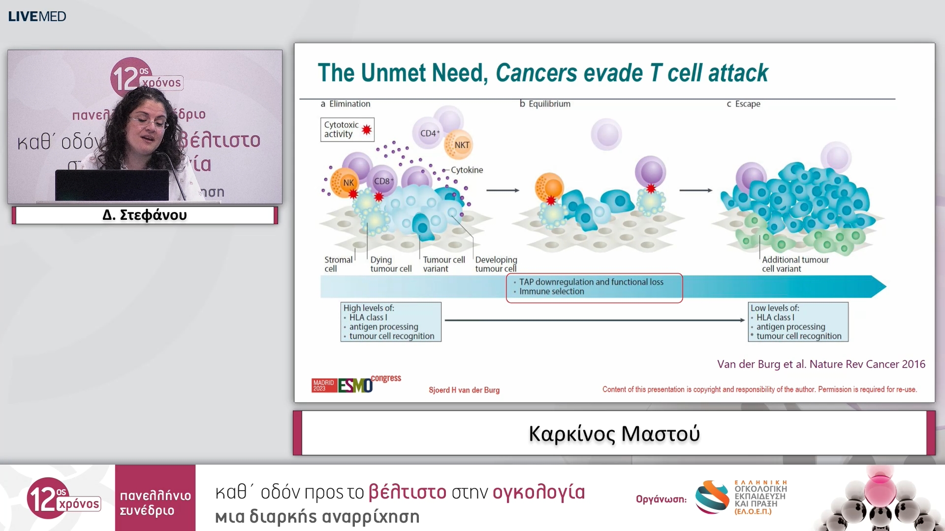 39 Δ. Στεφάνου - Kαρκίνος Μαστού