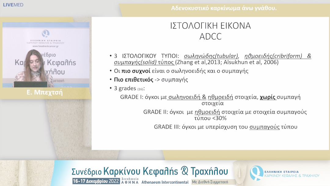 35 Ε. Μπεχτσή - Αδενοκυστικό καρκίνωμα άνω γνάθου.