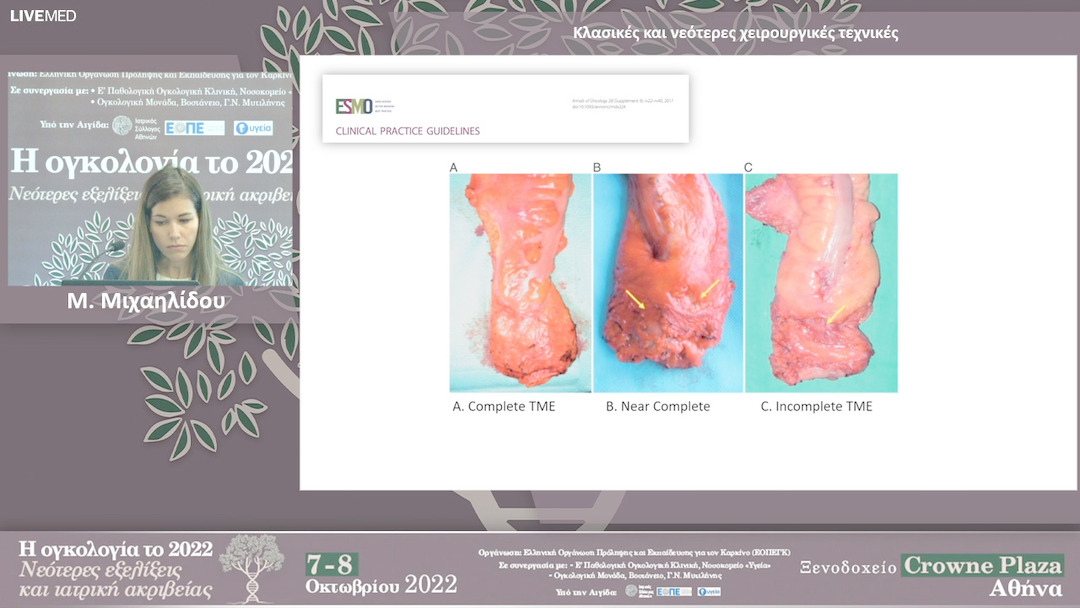 26 Μ. Μιχαηλίδου - Κλασικές και νεότερες χειρουργικές τεχνικές 