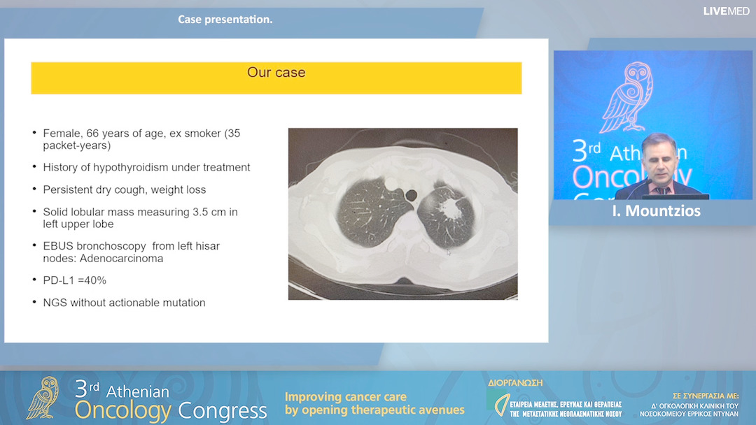 27 I. Mountzios - Case presentation.