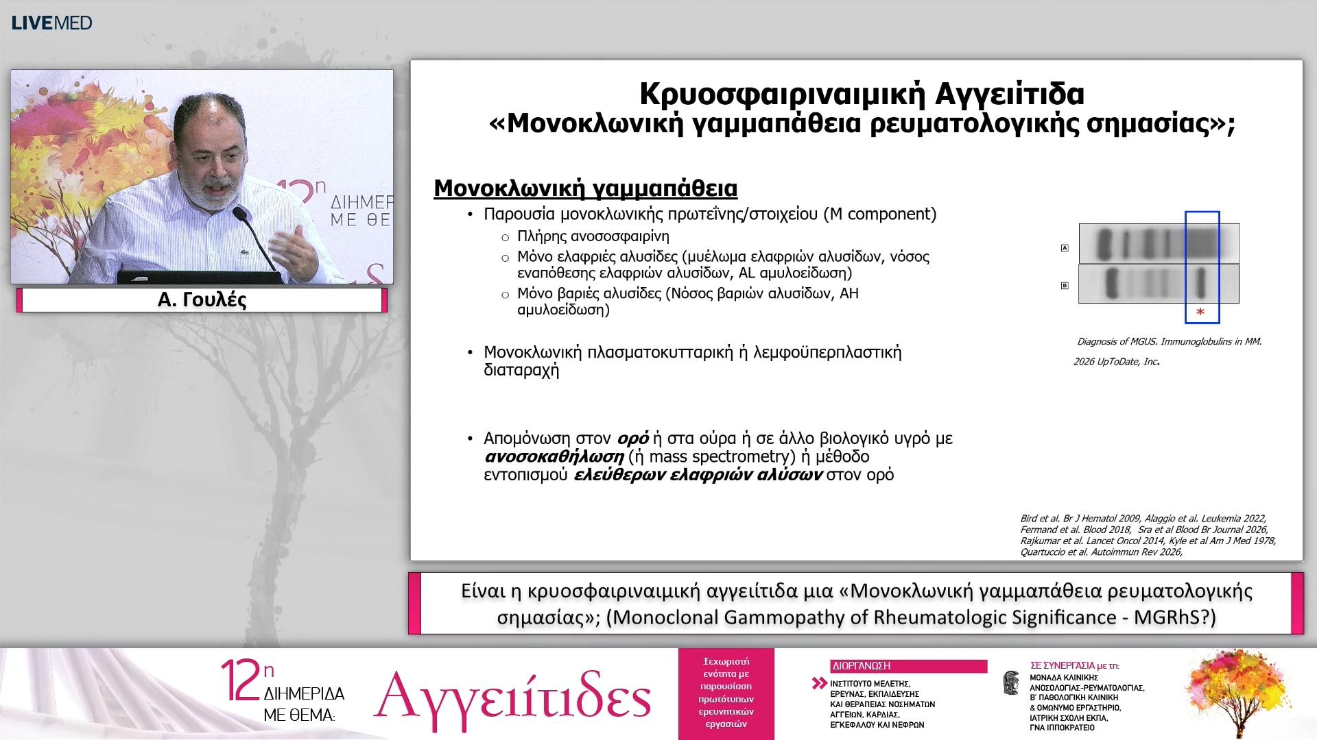 41 Α. Γουλές - Είναι η κρυοσφαιριναιμική αγγειίτιδα μια «Μονοκλωνική γαμμαπάθεια ρευματολογικής σημασίας»; (Monoclonal Gammopathy of Rheumatologic Significance - MGRhS?) 
