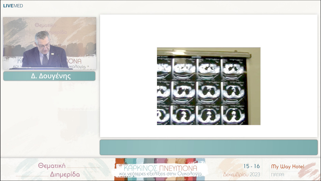 25 Δ. Δουγένης