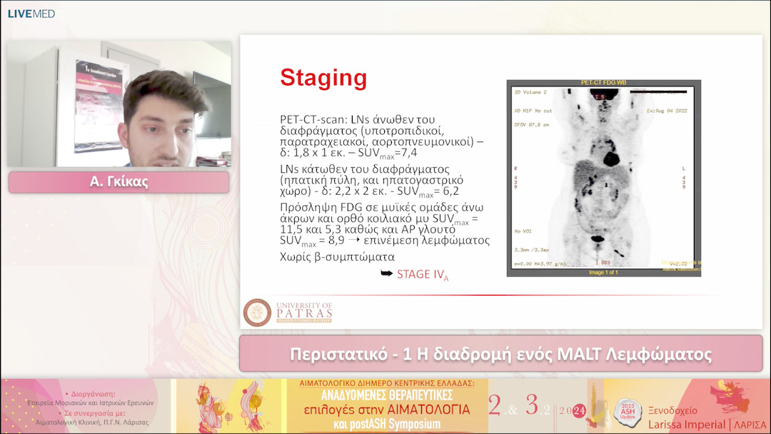 15 Α. Γκίκας - Περιστατικό - 1 Η διαδρομή ενός MALT Λεμφώματος 