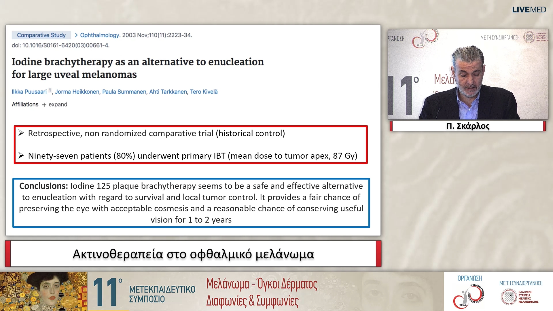 33 Π. Σκάρλος - Ακτινοθεραπεία στο οφθαλμικό μελάνωμα