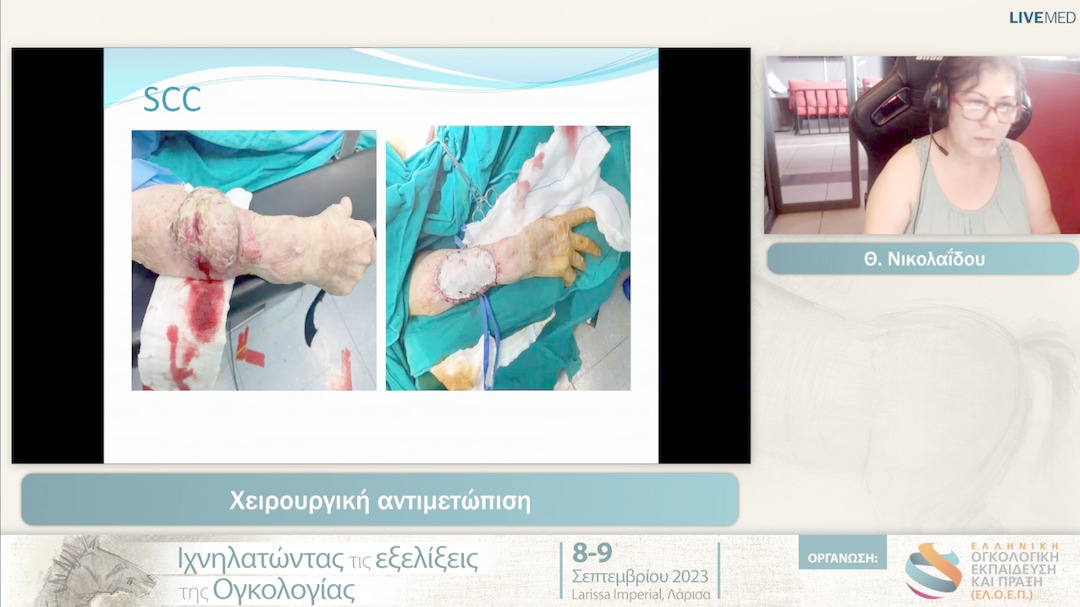 18 Θ. Νικολαΐδου - Χειρουργική αντιμετώπιση