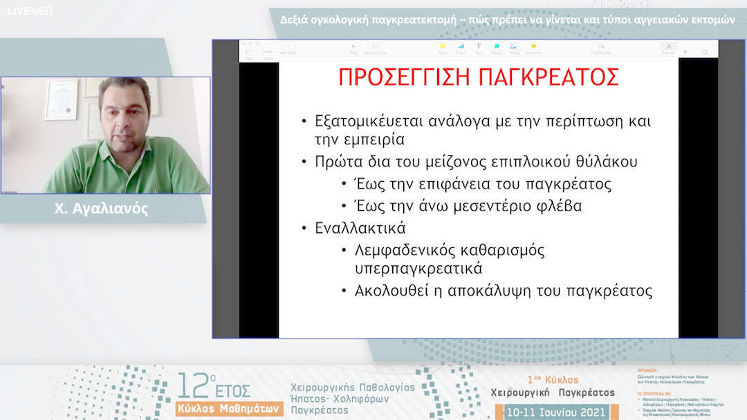 14 Χ. Αγαλιανός - Δεξιά ογκολογική παγκρεατεκτομή – πώς πρέπει να γίνεται και τύποι αγγειακών εκτομών 